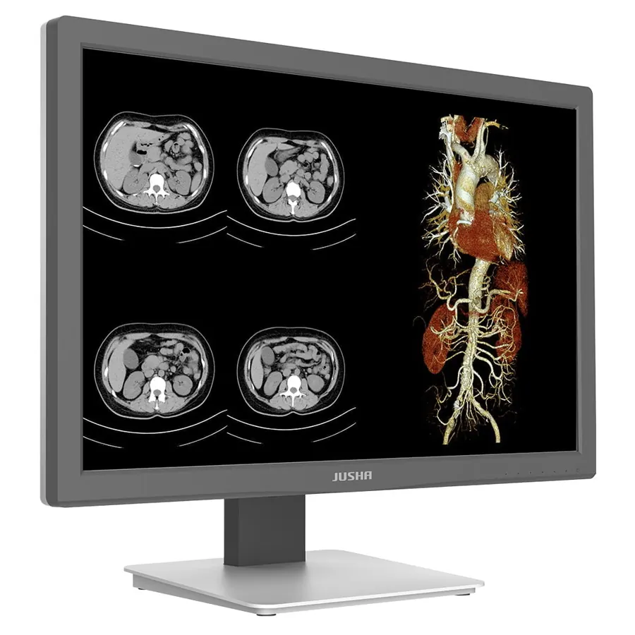 Monitor de Diagnóstico CR240G — equipamento médico distribuído pela 1000Medic