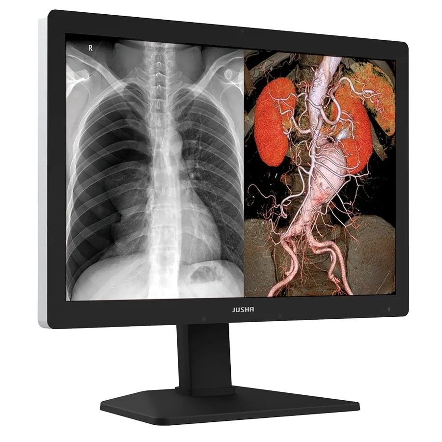 Monitor de Diagnóstico C630G — equipamento médico distribuído pela 1000Medic